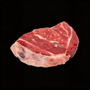 שריר קדמי - נתח מס׳ 8